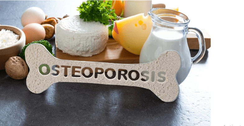 Natural Ways To Treat Osteoporosis Without Medication