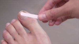 Amorolfine Nail Lacquer Online