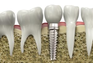 Oral Health