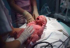 Birth Injuries