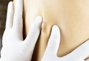 Skin Lumps