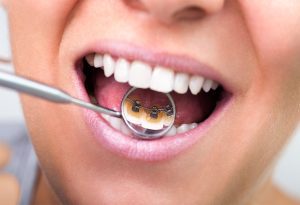 Orthodontist in San Francisco