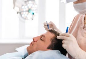 FUE Hair Transplant