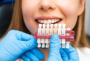 Teeth Whitening